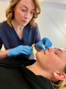 Lip Filler Kettering with instant results